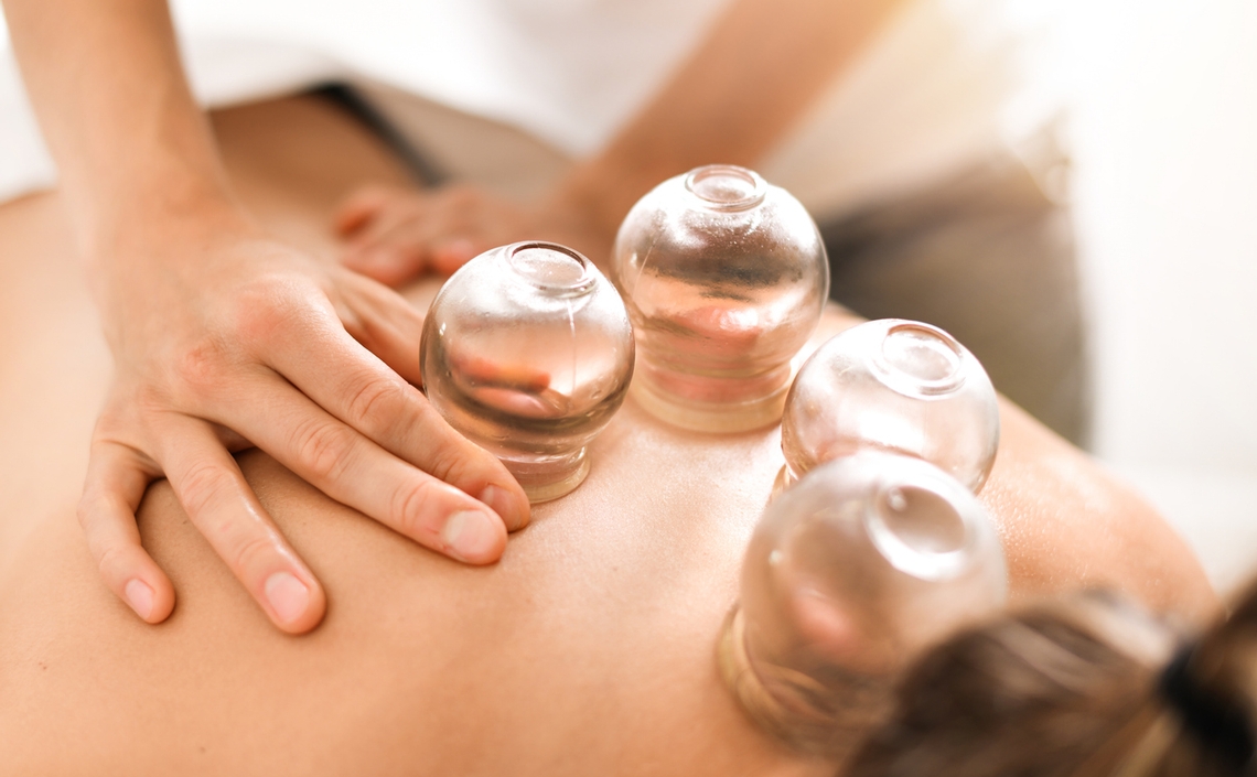 Cupping Therapy